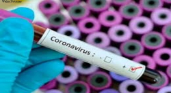 AUMENTA A 91 EL NÚMERO DE CASOS DE CORONAVIRUS EN VENEZUELA