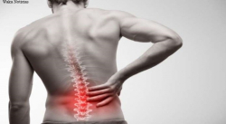 DOLOR DE ESPALDA: LA RAZÓN POR LA QUE EL 70% DE LA POBLACIÓN LO PADECERÁ ALGUNA VEZ