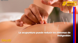 LA ACUPUNTURA PUEDE REDUCIR LOS SÍNTOMAS DE INDIGESTIÓN