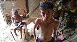 CÁRITAS VENEZUELA DENUNCIA QUE 34% DE LOS NIÑOS POBRES PADECEN DESNUTRICIÓN CRÓNICA