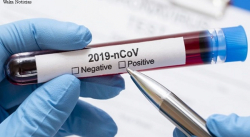 AMAZONAS REGISTRÓ ESTE MIÉRCOLES 9 CASOS POSITIVOS DE COVID-19