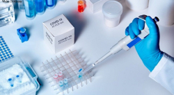 VENEZUELA SUMÓ 1.086 NUEVOS CASOS Y 8 DECESOS POR COVID-19 DURANTE LAS ÚLTIMAS 24 HORAS