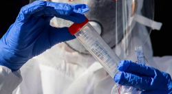 OMS ANUNCIA “BUENAS NOTICIAS” POR DESARROLLO DE VACUNAS CONTRA EL CORONAVIRUS