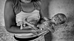 SEIS DE CADA 10 NIÑOS VENEZOLANOS PRESENTAN DETERIORO NUTRICIONAL